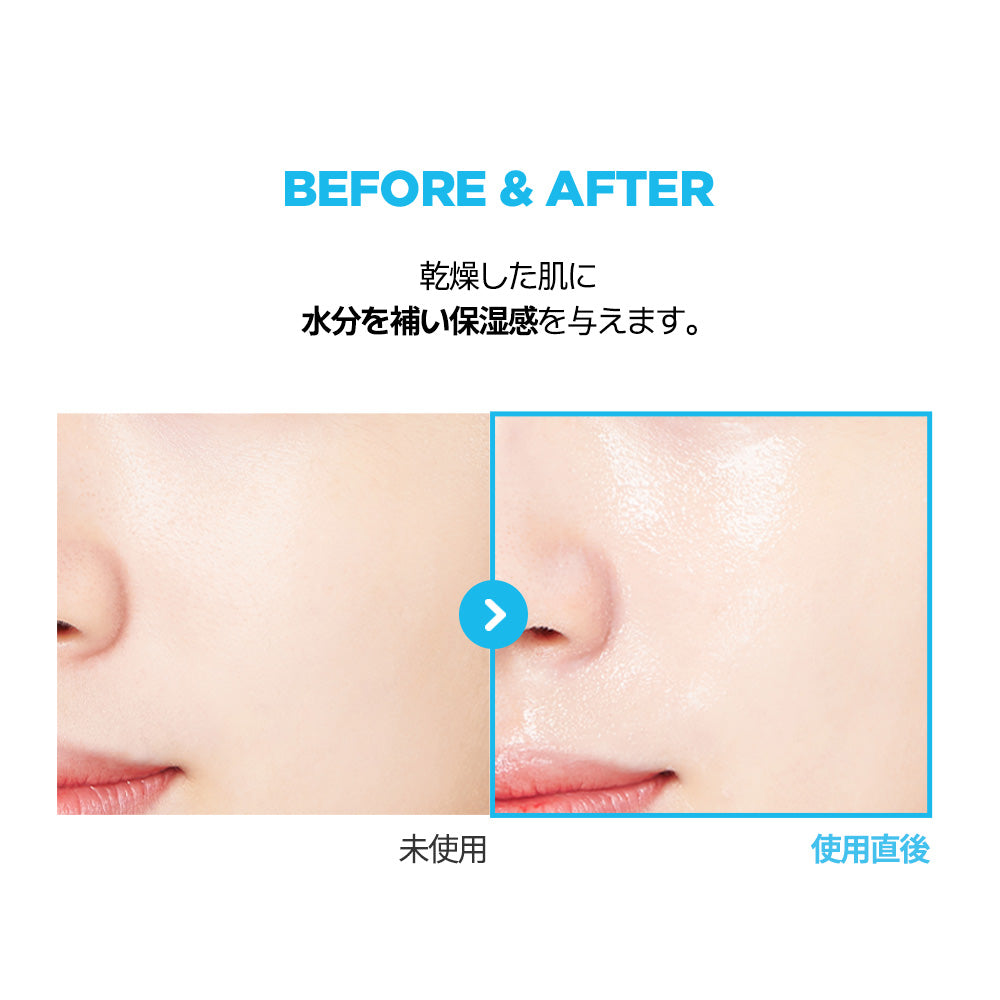 専用　美容液、化粧水、フェイスマスク JMsolution公式店 】ウォータールミナス S.O.Sリンガーマスクプラス